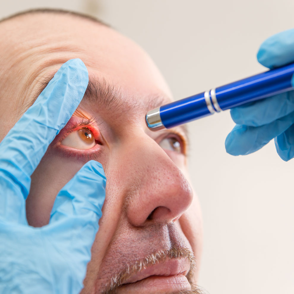 Zovirax ® Augensalbe ausser Handel – Finden Sie Aciclovir Augensalbe bei uns!